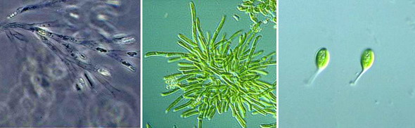Слева направо: динобрион балтийский (колония золотистых водорослей), жёлто-зелёные водоросли (микротамнион, харациопсис периформис)