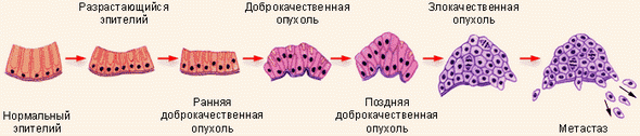 Образование раковой опухоли