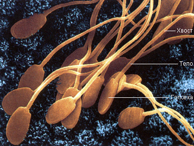 Сперматозоиды человека (электронный микроскоп)